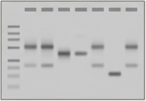PCR electrophoregram